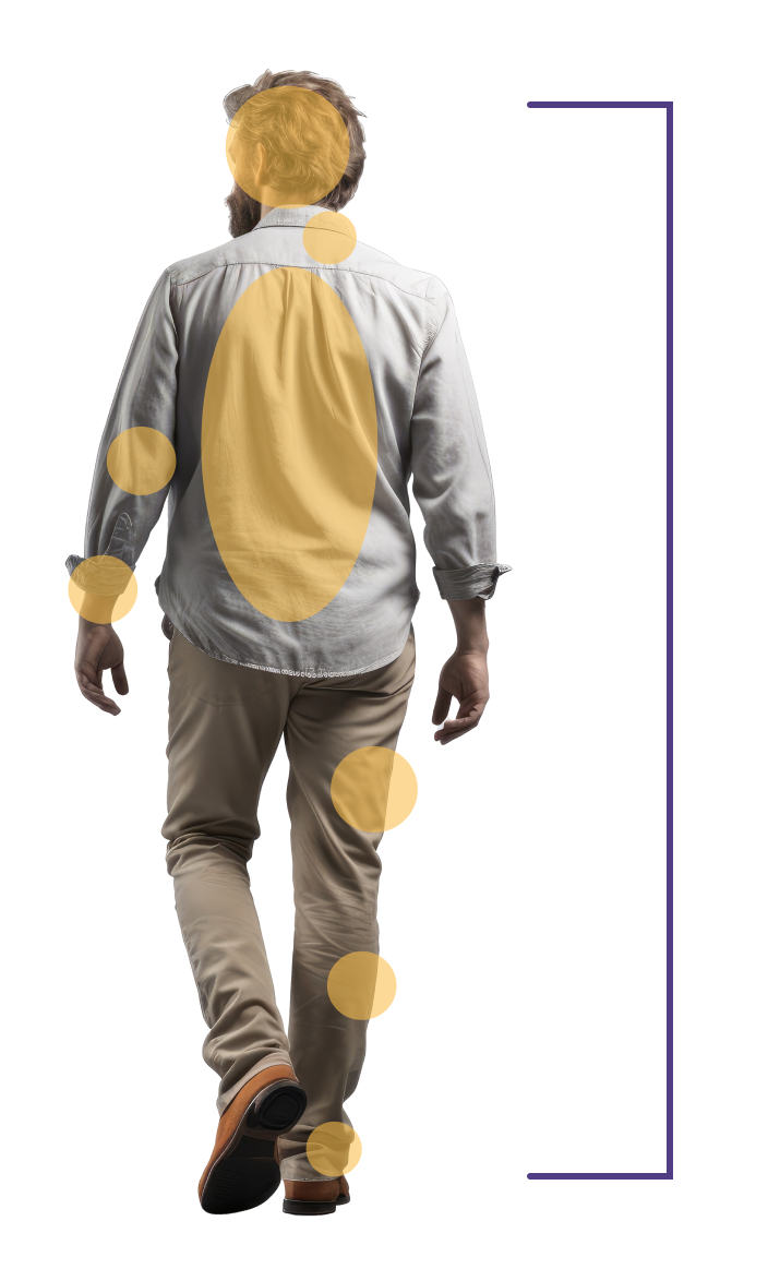 Diagram illustrating where plexiforms can grow in the body.